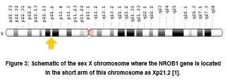 The Role of Mutations on Gene NROB1 in X-linked Adrenal Hypoplasia Congenital Syndrome.