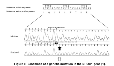 The Role of Mutations on Gene NROB1 in X-linked Adrenal Hypoplasia Congenital Syndrome.