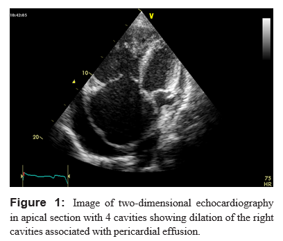 Evaluation of Systolic Function of the Right Ventricle in Patients with Chronic Obstructive Pulmonary Disease: A Cross Sectional Study about 30 Cases